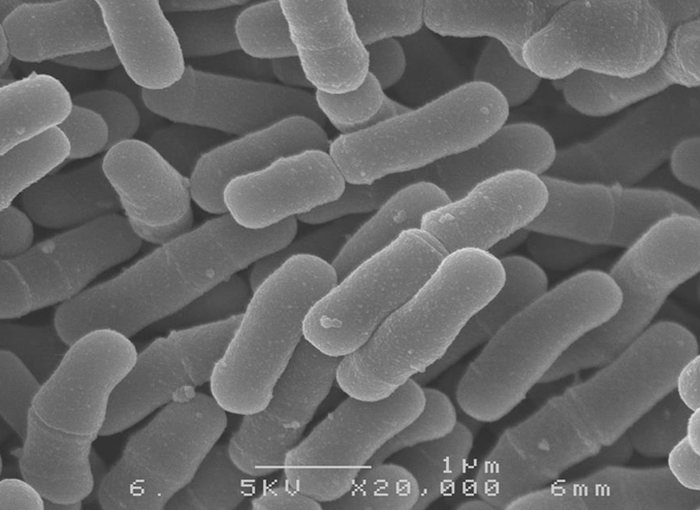 Bifidobacterium infantis M-63 Bifidobacterium infantis M-63